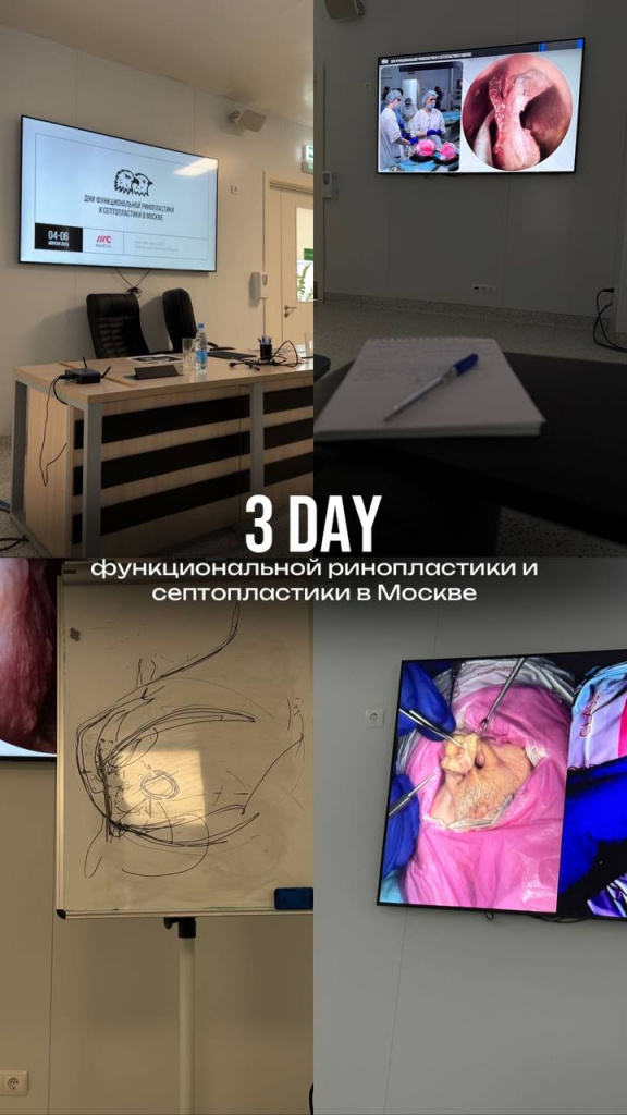 кадры из участия доктора Репиной Аси в конференции «Дни функциональной ринопластики и септопластики»